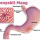 Illustration for article titled Obat Maag Alami Dari Buahem/em